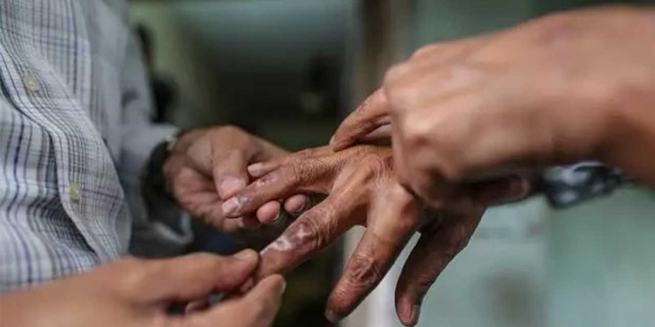 Erken teşhisle cüzzamdan korun