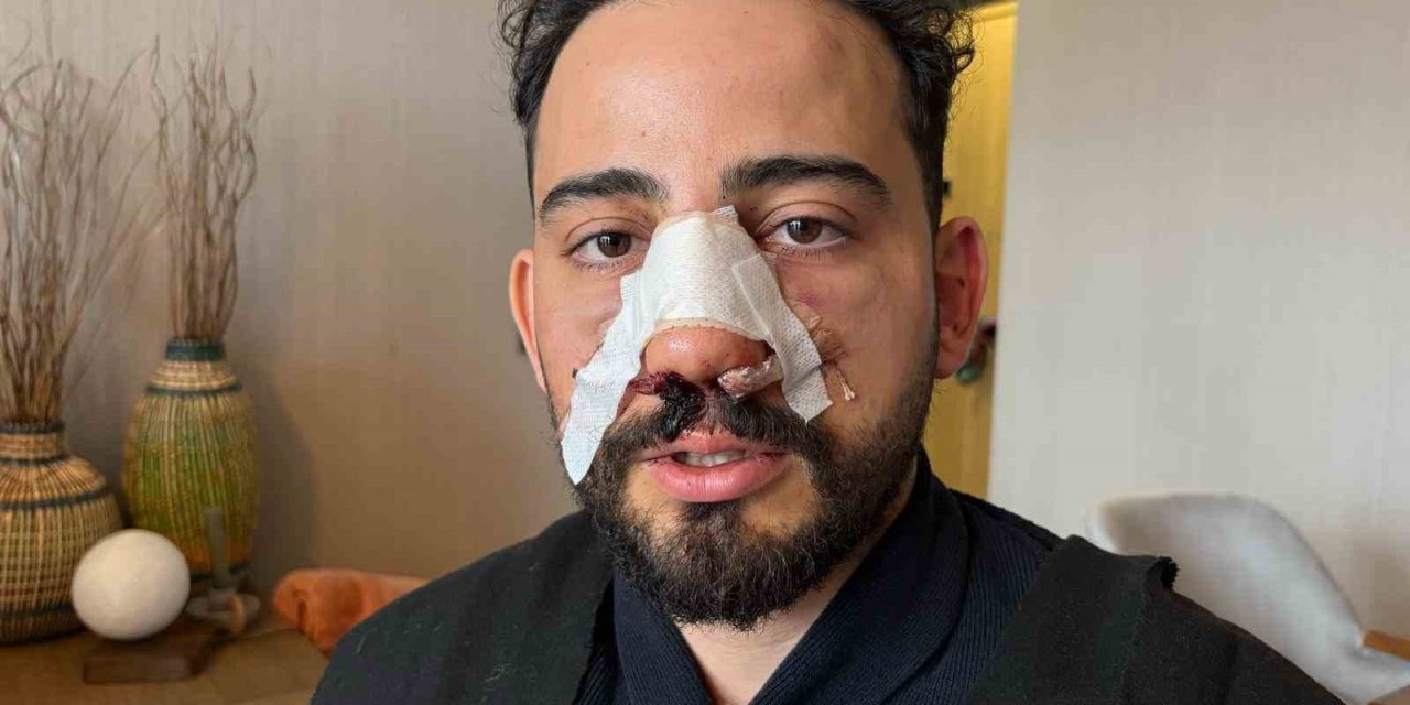 Siparişler geciktiği için gitmek isteyen müşteriye restoran çalışanlarından öldüresiye darp