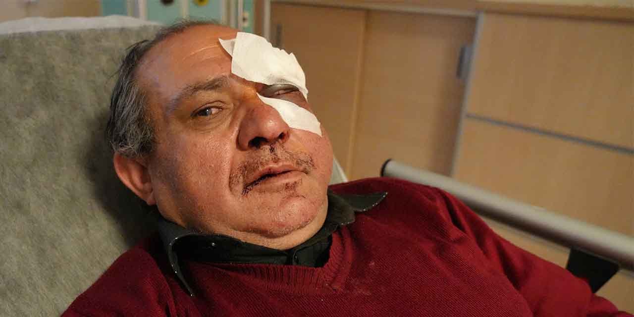 Kırıkkale'de doktoru darbeden şahıslar serbest bırakıldı