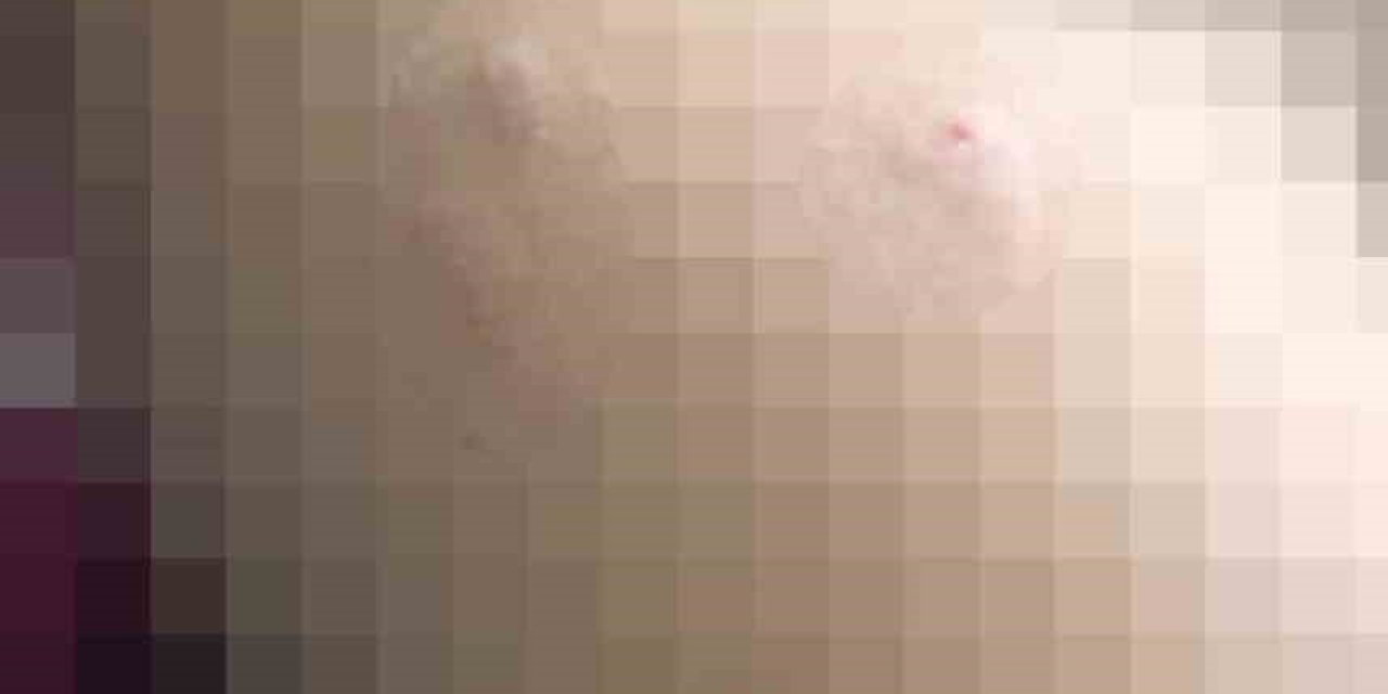 Sokak köpeği 5 yaşındaki çocuğa saldırdı