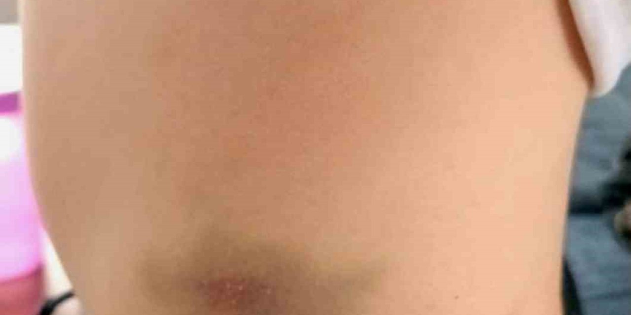 Ankara’da özel okulda akran şiddeti iddiası