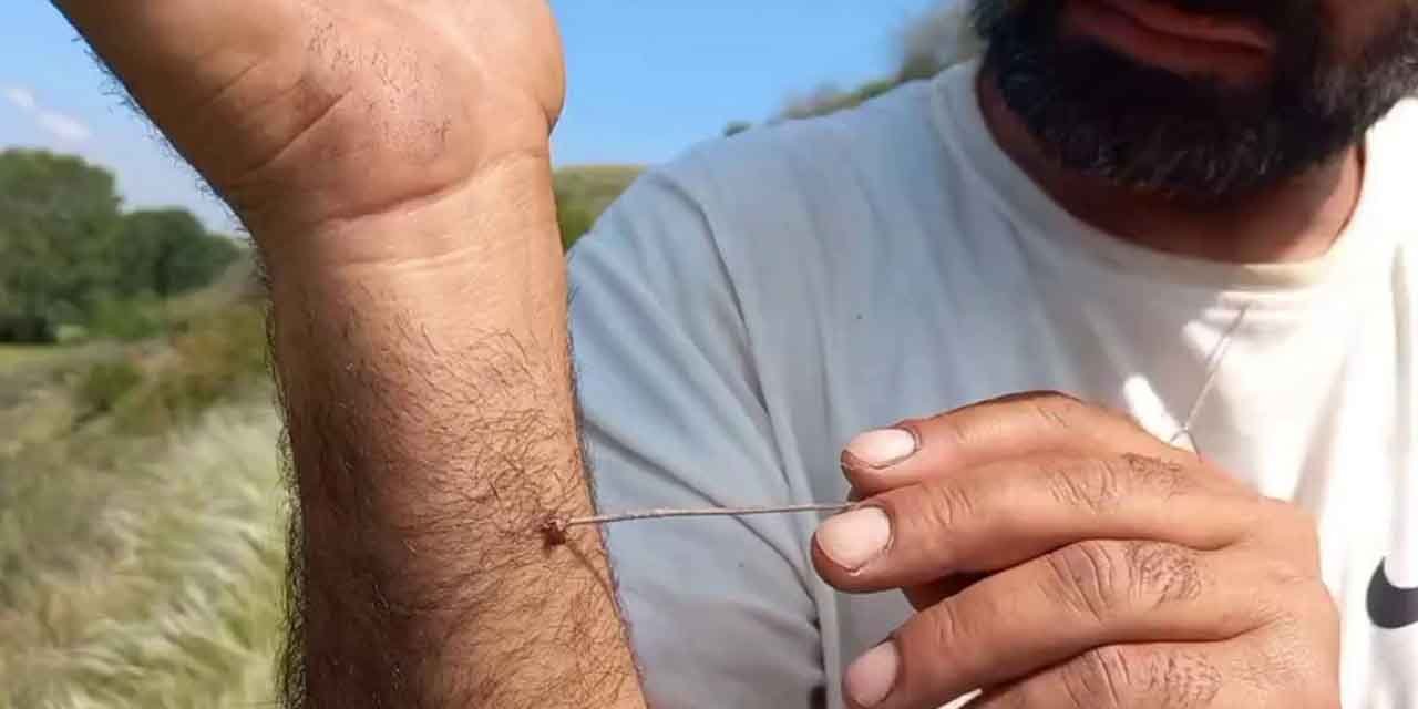 Kenenin vücutta kalma süresi hastalığı yükseltiyor!