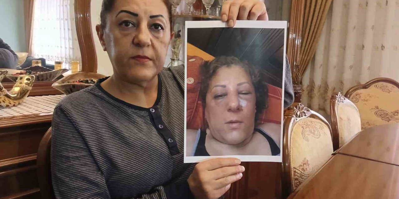 Apartman bahçesinde beslediği kediler nedeniyle komşuları tarafından darbedilen kadının burnu kırıldı