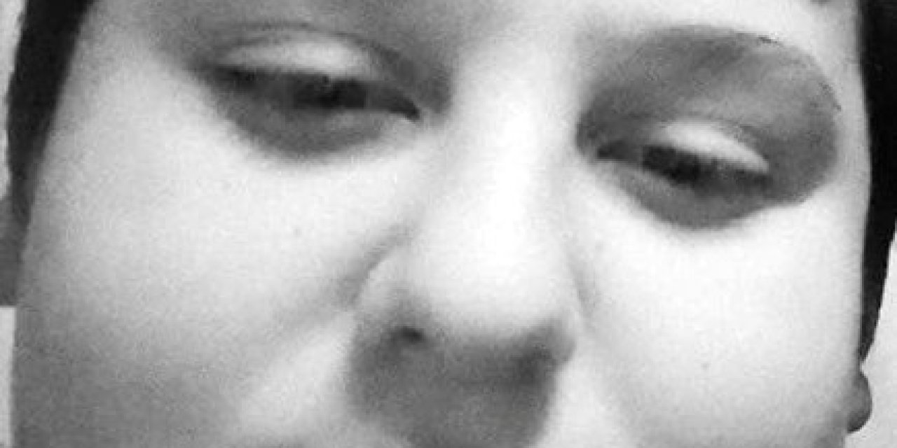 Lise öğrencisi motosiklet kazasında hayatını kaybetti