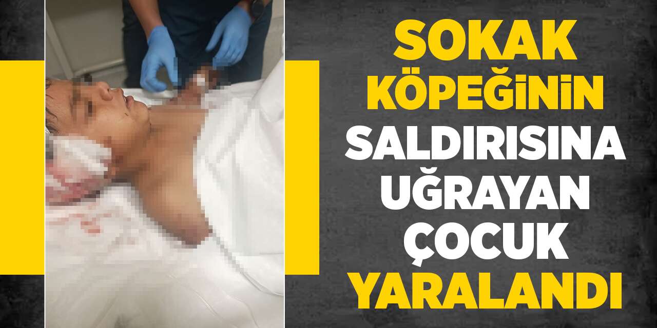 Sokak köpeğinin saldırısına uğrayan çocuk yaralandı