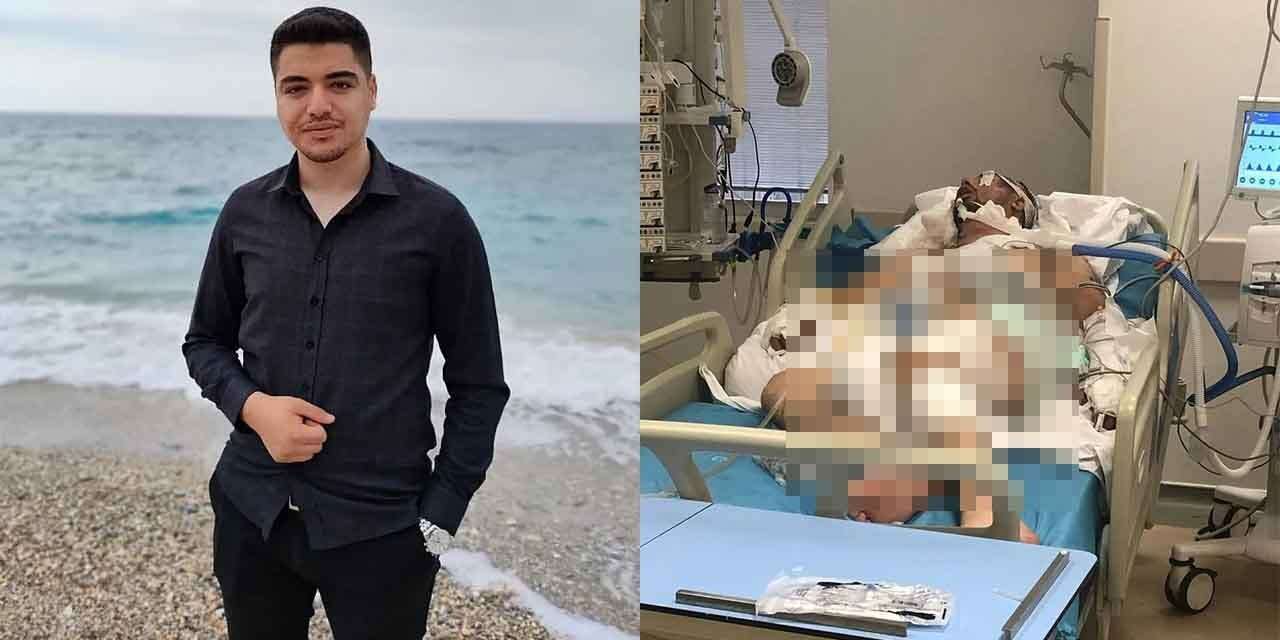 Kırıkkaleli Gökberk yaşam savaşını kaybetti!