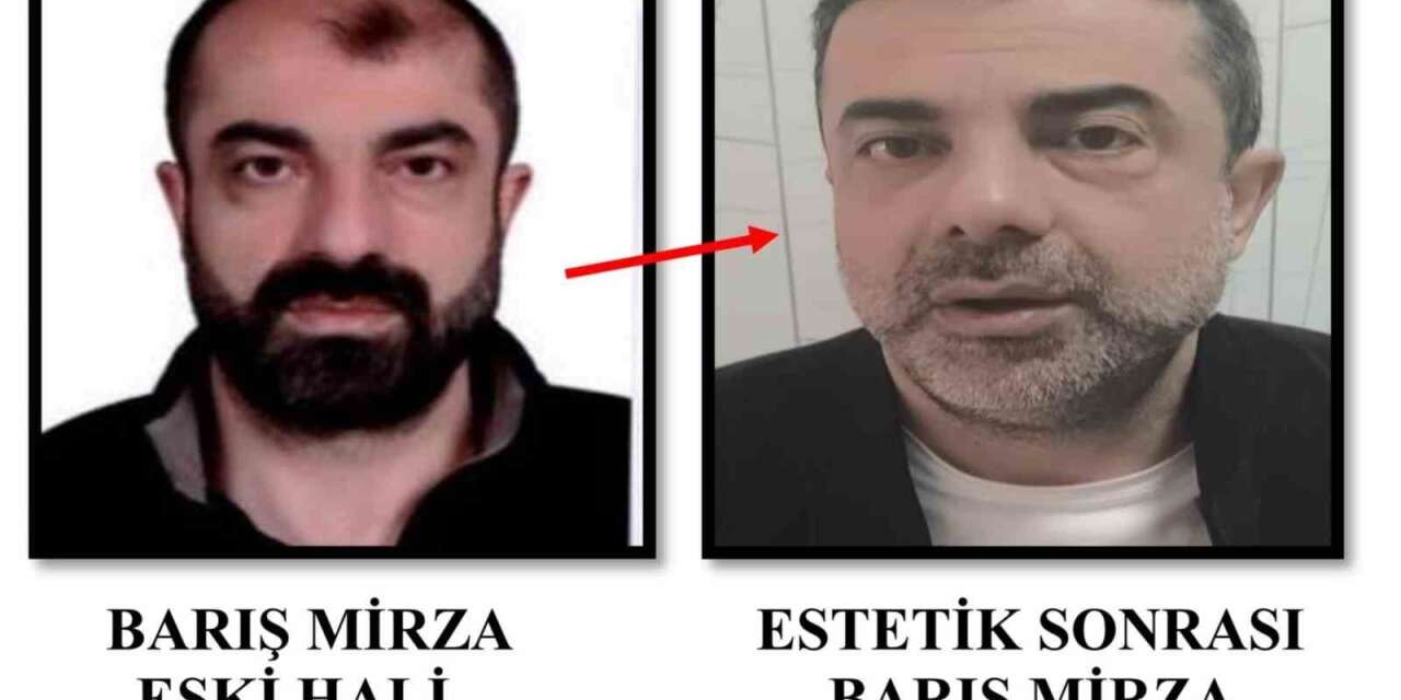 Ameliyat ile yüzünü değiştirdi! Firari cinayet zanlısı yakalandı