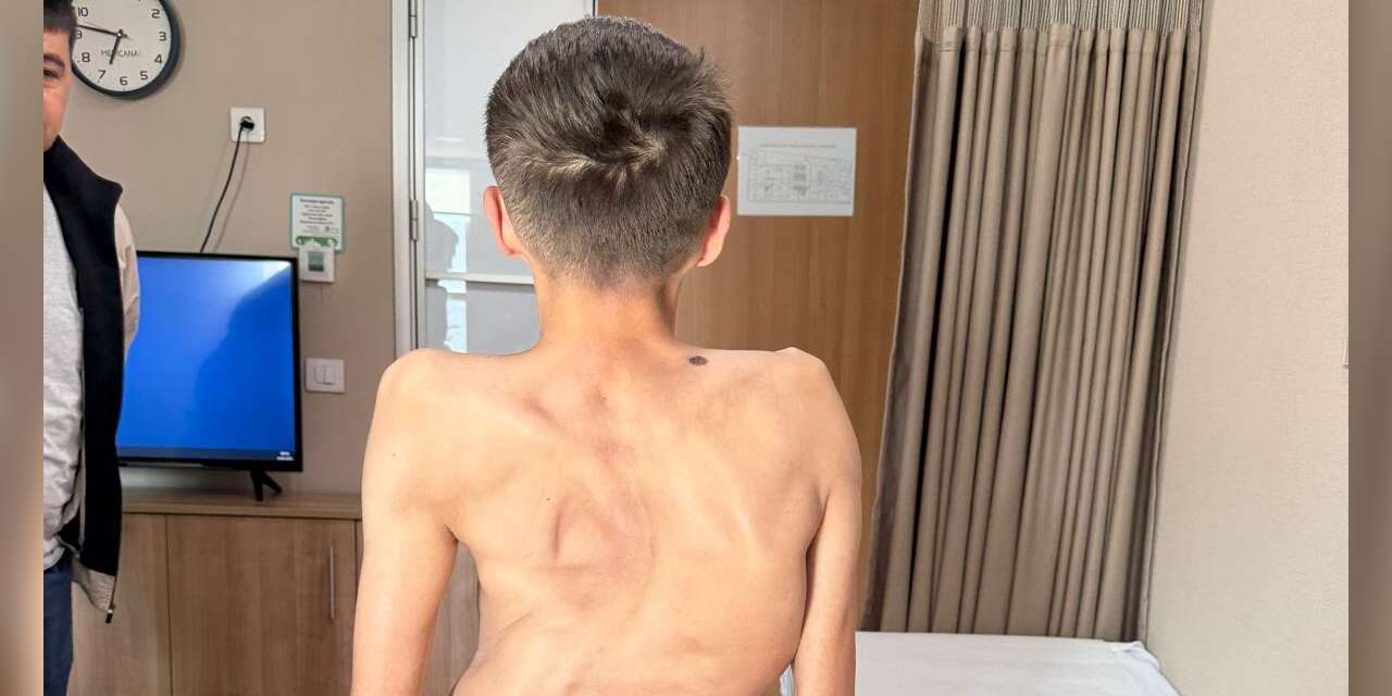 Kırgızistanlı genç şifayı Türk hekimlerinde buldu